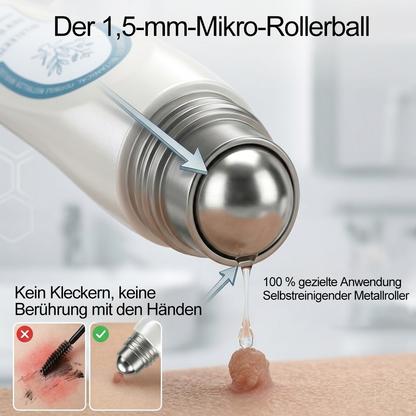 Offizieller Markenstore |✅𝑷𝑖𝒄𝐝𝐨® 7-𝑻𝒂𝒈𝒆 𝑯𝒂𝒖𝒕𝒂𝒏𝒉ä𝒏𝒈𝒔𝒆𝒍- & 𝑭𝒍𝒆𝒄𝒌𝒆𝒏𝒆𝒏𝒕𝒇𝒆𝒓𝒏𝒆𝒓(Schmerzfreier Rollerball – Keine Narbenbildung)🚀